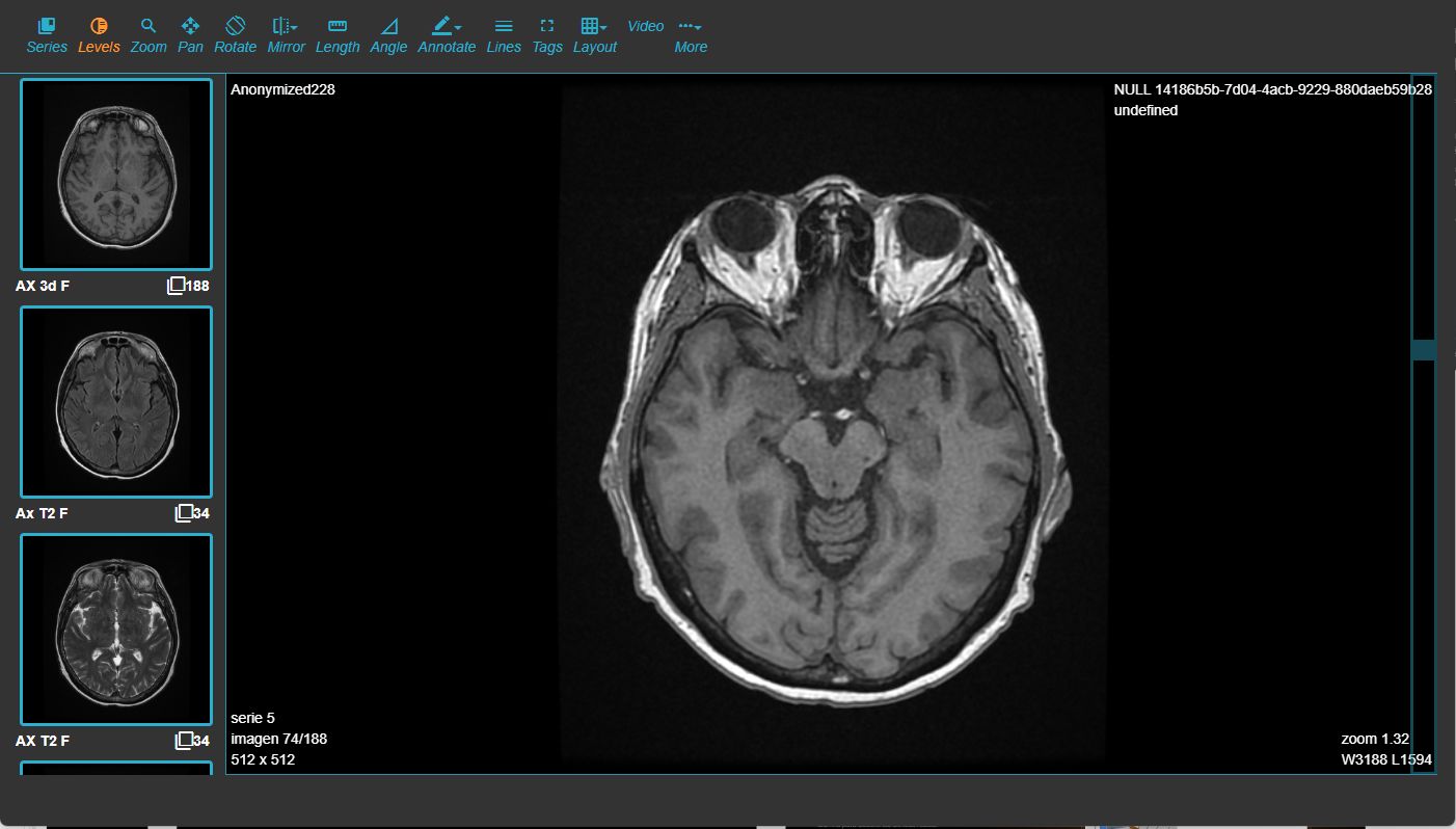 DICOM Viewer